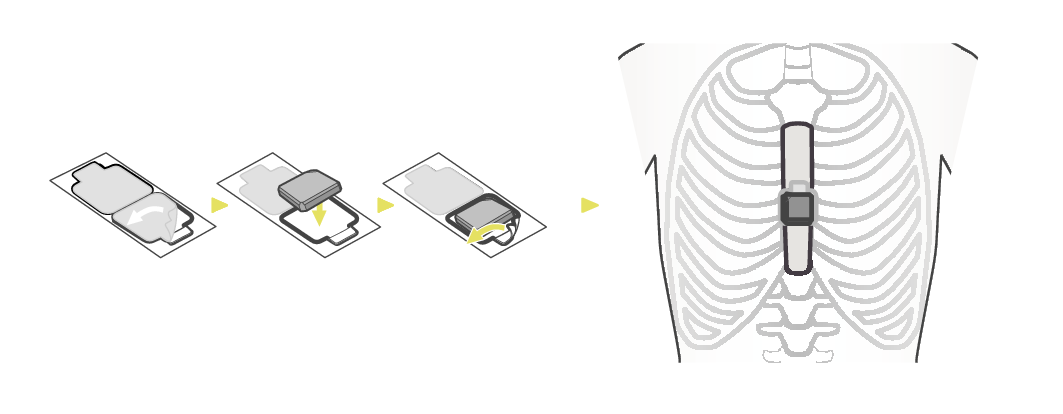 LEOMO_Motion_Sensors_Torso_Sacrum_S + LEOMO_Motion_Sensors_Torso_Sacrum_S